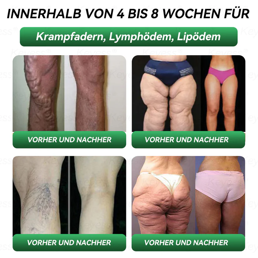 Schlankheits- Gesundheits-Tropfen - Image 10