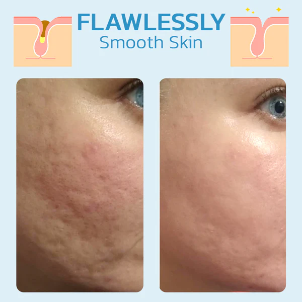 Oligopeptide Foam Cleansing Serum - Image 6