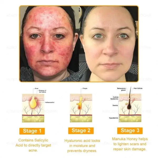 7-Day Multi-Effect All-in-one Skincare Cream - Image 5