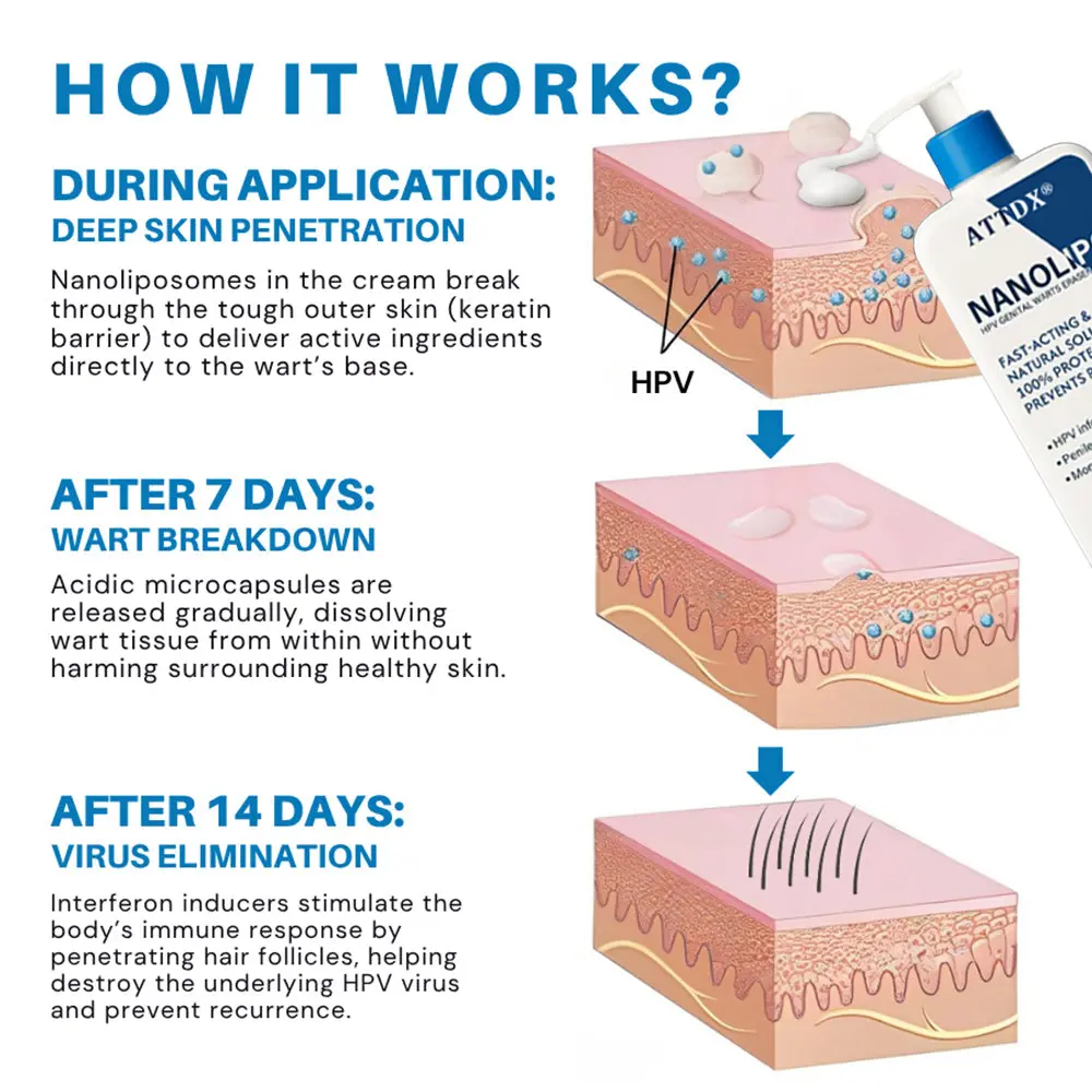 NanoLipo HPV Genital Warts Eraser Cream - Image 5