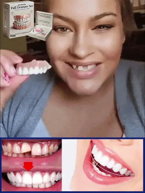 🦷Advanced Customized Full Denture Set🦷 - Image 6