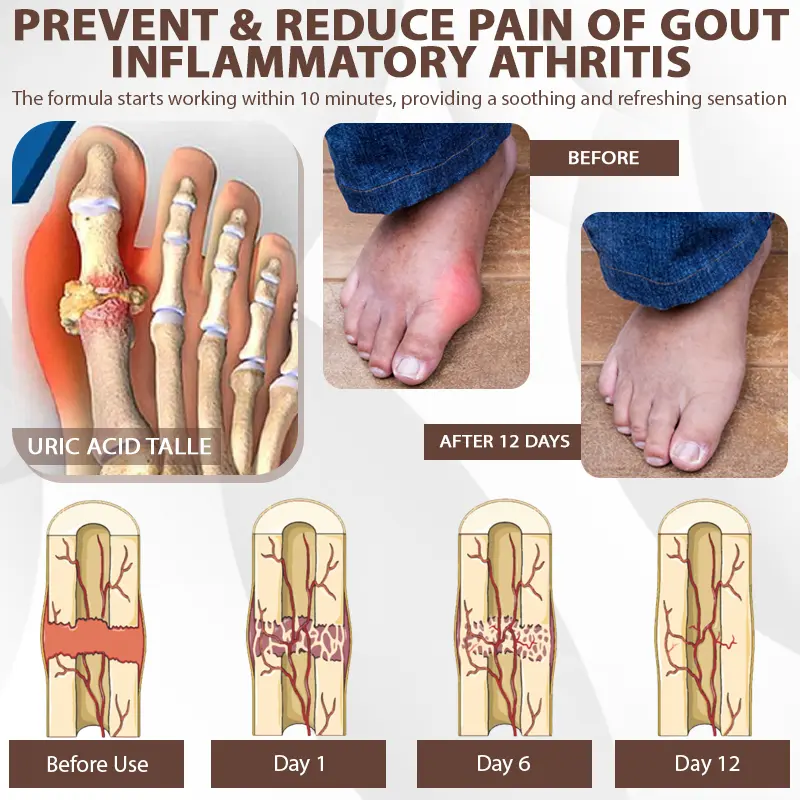Joint Support Formula Spray - Image 8