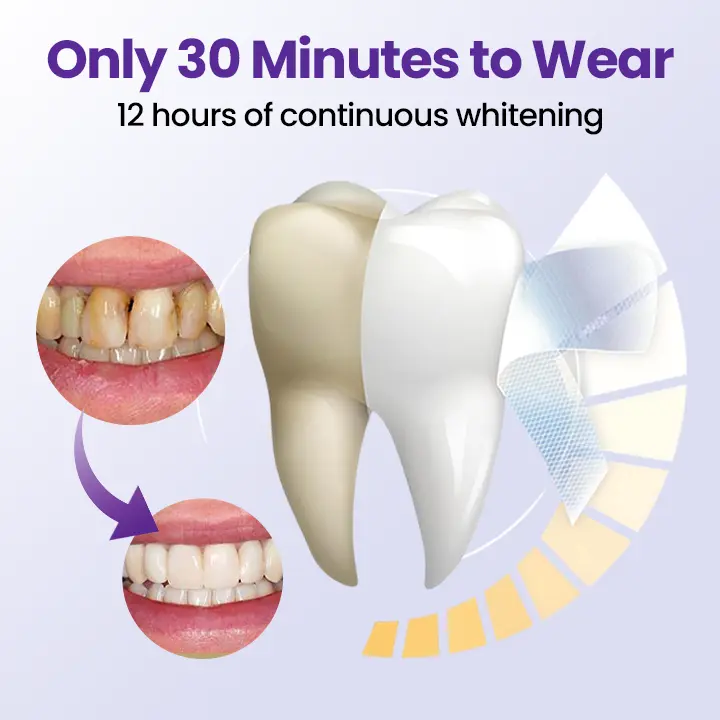 5D Teeth Whitening Strips - Image 7