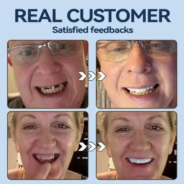 𝐏𝐫𝐞𝐦𝐢𝐮𝐦 𝐃𝐞𝐧𝐭𝐮𝐫𝐞 - Image 8