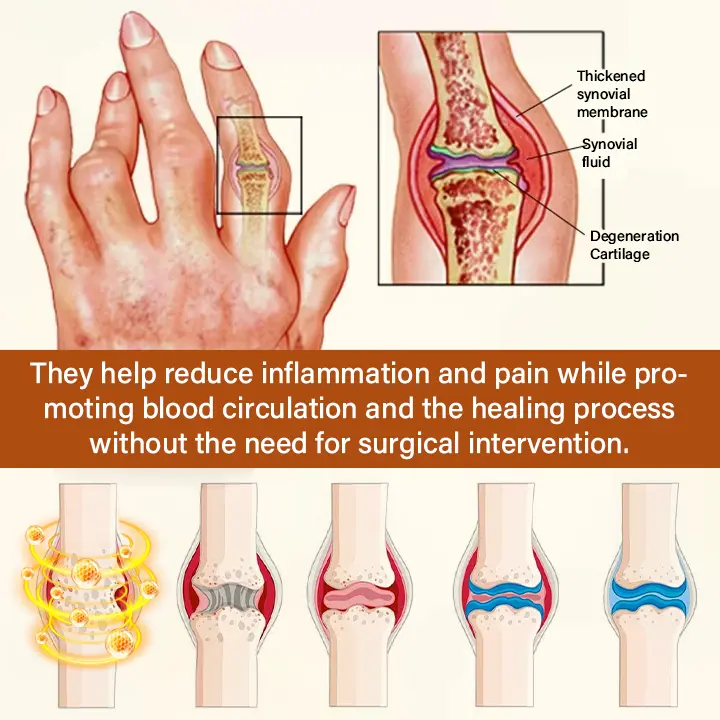 Joint Cream - Image 7