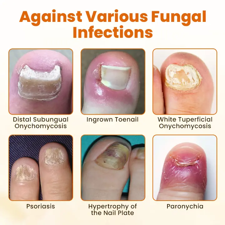 Bee Venom Nail Spray - Image 7