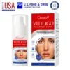 Vitiligo Treatment Spray