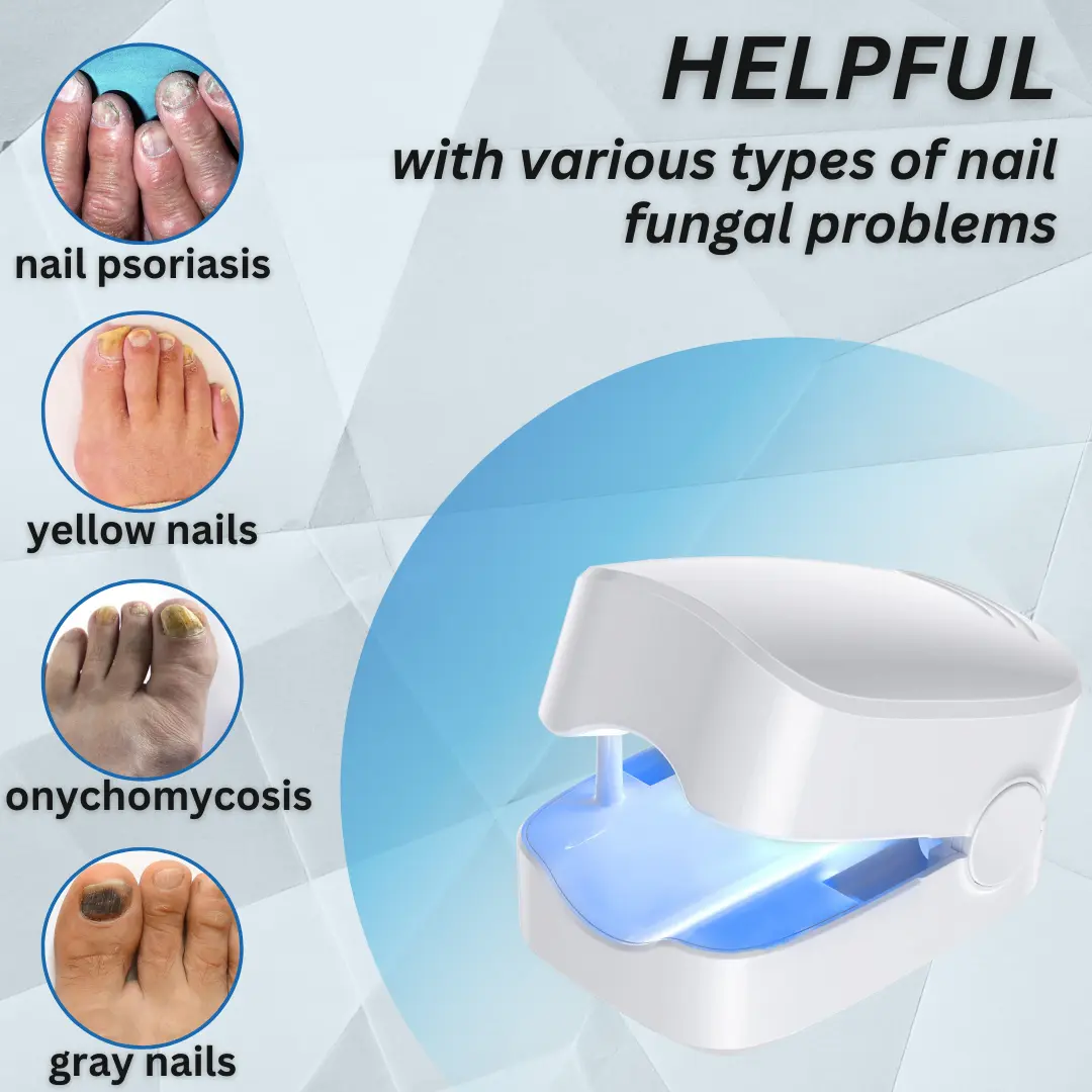 Nail Fungus Laser Treatment Device - Image 2