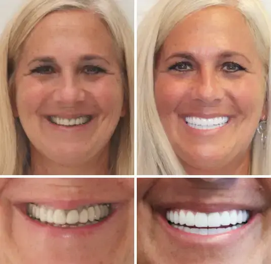 Perfect Smile - Image 8