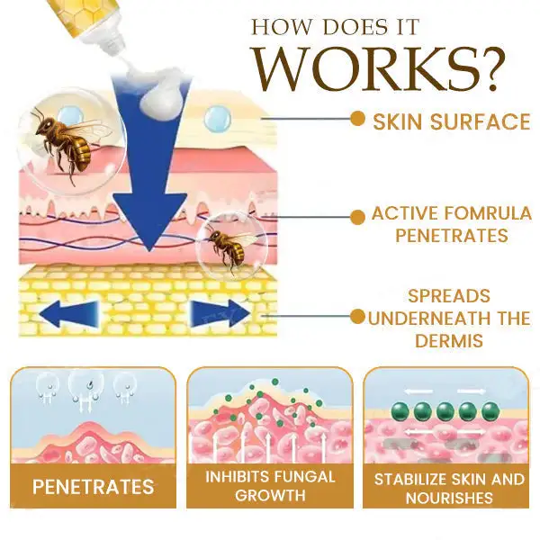 Bee Toxin Anti-Itch Cream - Image 5