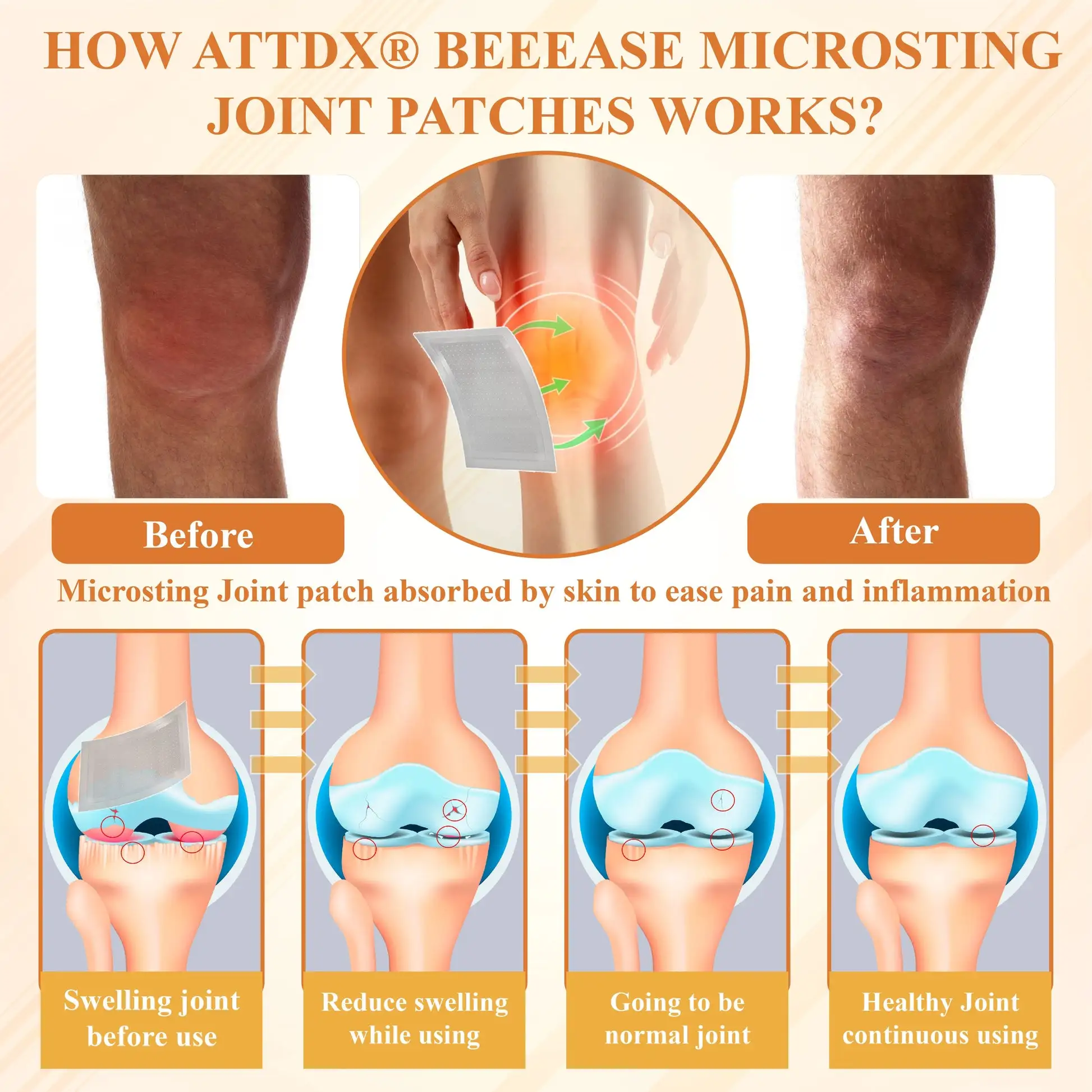 BeeEase MicroSting Joint Patches - Image 10