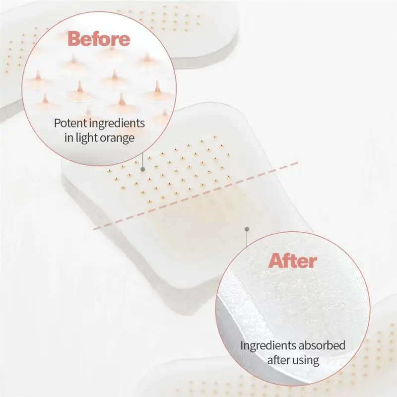 BeeEase MicroSting Joint Patches - Image 6