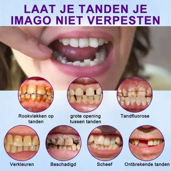 Geavanceerde op maat gemaakte volledige protheseset🌸 - Image 10