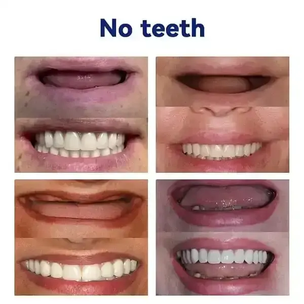 ๐ฆท๐๐๐ฏ๐๐ง๐๐๐ ๐๐ฎ๐ฌ๐ญ๐จ๐ฆ๐ข๐ณ๐๐ ๐
๐ฎ๐ฅ๐ฅ ๐๐๐ง๐ญ๐ฎ๐ซ๐ ๐๐๐ญ๐ฆท (๐ฟLimited time discount last 30 minutes๐ฟ)๐ฟ๐ฟ - Image 7