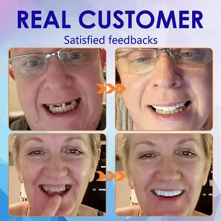 💝Premium Advanced Customized Full Denture Set 💝 (⏰Limited time discount last 30 minutes) - Image 4