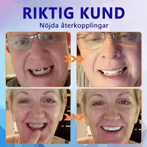 đ§ĄPremium Avancerat Anpassat Helprotes-set đ§Ą (â°TidsbegrĂ€nsad rabatt i 30 minuter) - Image 10