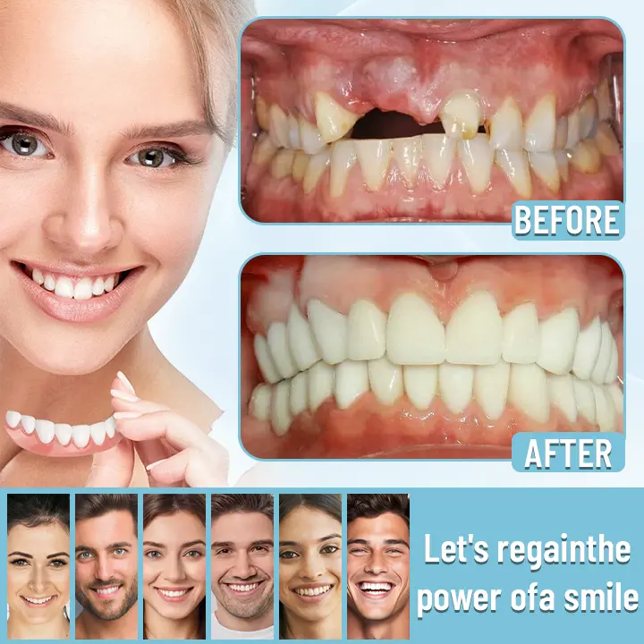 Premium Customized Full Denture Set🦷 - Image 8