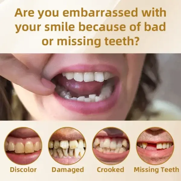 –🦷Advanced Customized Full Denture Set🦷 (⏰Limited time discount last 30 minutes⏰)💎💎 - Image 8