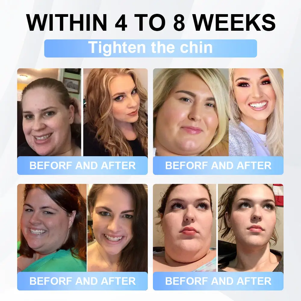 Nano Microneedle Patch - Image 2