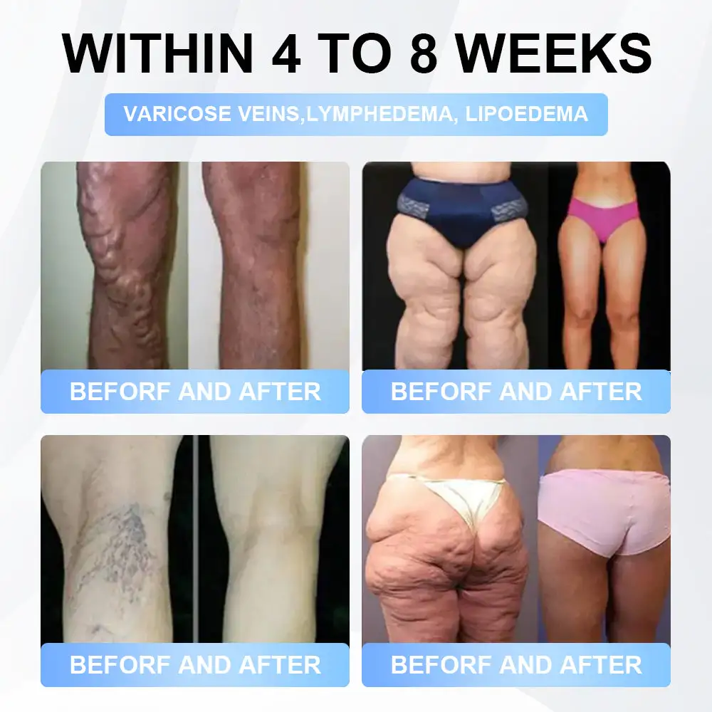 Nano Microneedle Patch - Image 5