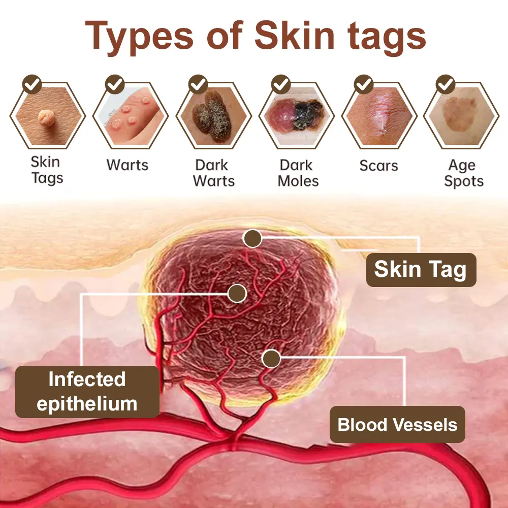 Black Rice Skin Repair Essence Cream - Image 10