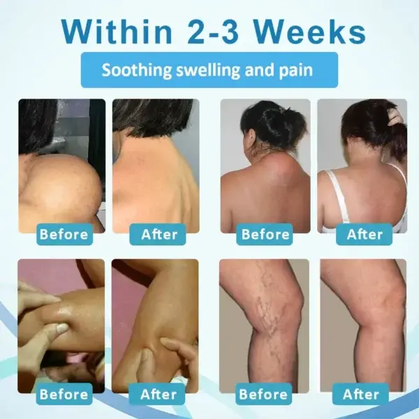 Support Roll-On - Image 2