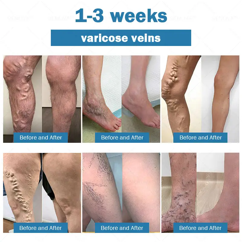 ๐ต๐๐๐ ๐ด๐๐๐๐๐๐๐๐
๐๐ ๐ท๐๐๐๐ - Image 8