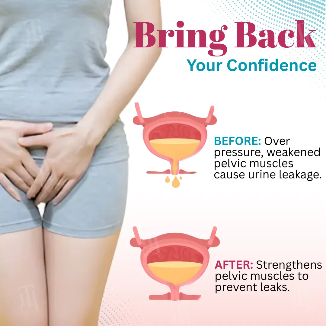 Bladder Control Patch - Image 4