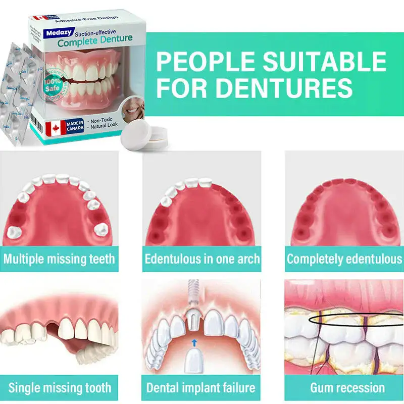 Suction-fit Complete Denture 🦷🍎🍏 - Image 6