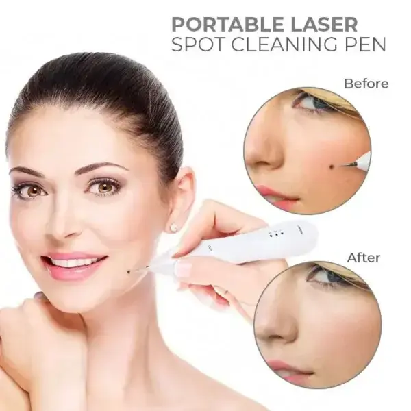 Portable Laser Spot Cleaning Pen - Image 2
