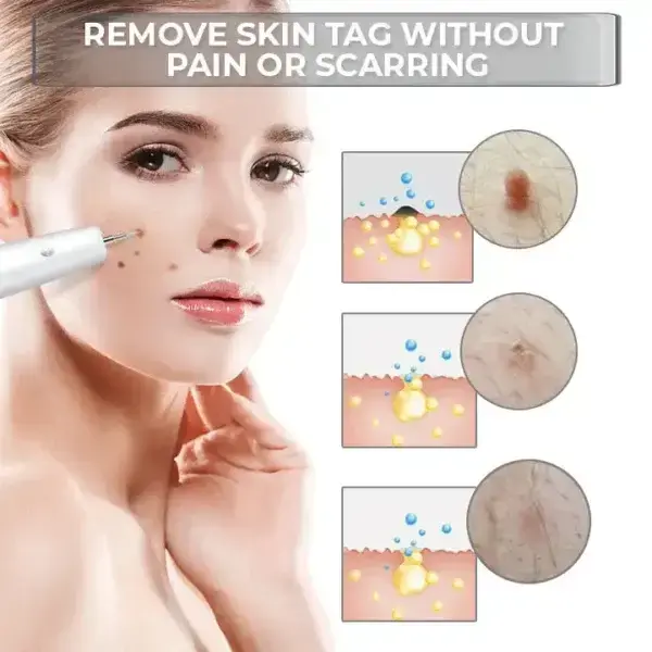 Portable Laser Spot Cleaning Pen - Image 6