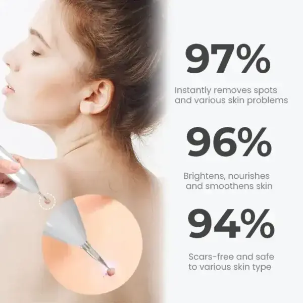 Portable Laser Spot Cleaning Pen - Image 7