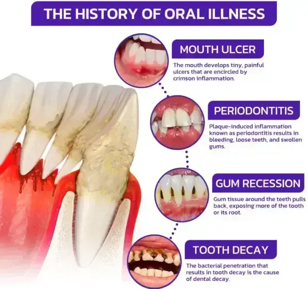 VioCore Bee Venom Dental Treatment Toothpaste - Image 9