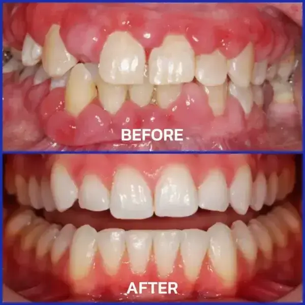 VioGloss Bee Venom Dental Therapy Oral Power🦷 - Image 9