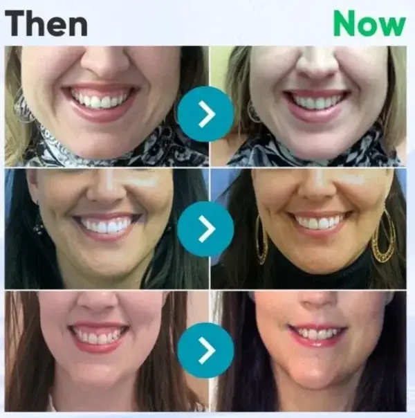 Bienengift-Zahntherapie Oral Power - Image 8