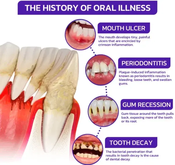 Bienengift-Zahntherapie Oral Power - Image 5