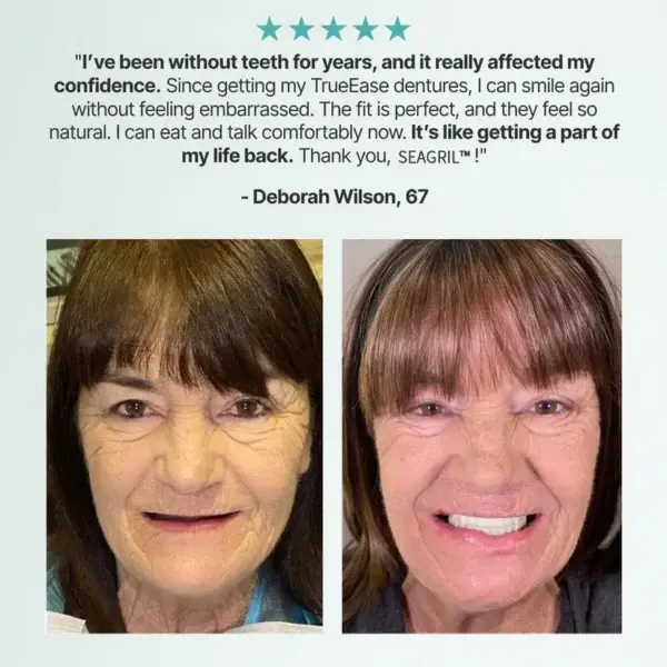 Professional Denture Maintenance Kit - Image 6