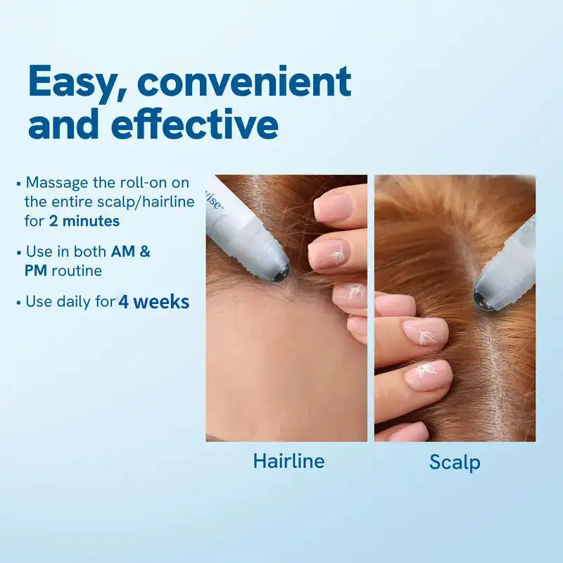 Advanced Anti-Hair Loss Roll-On – See hair growth in 1-2 weeks - Image 3
