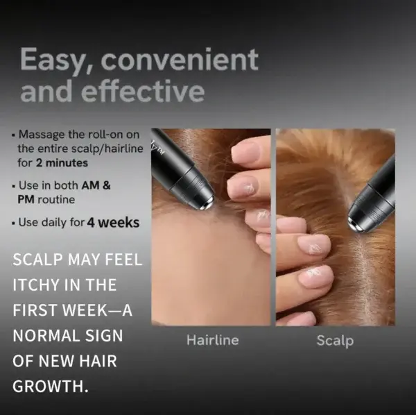 Professional Anti-Hair Loss Roll-On – Stimulates Hair Growth in 1–2 Weeks - Image 3
