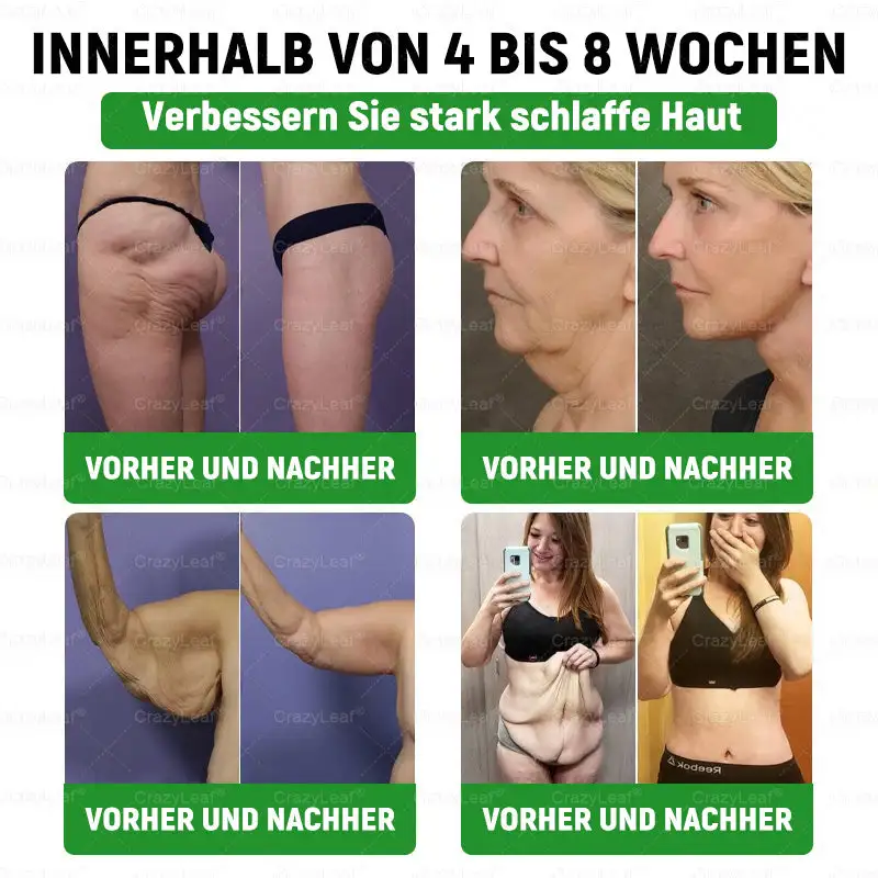 ๐บ๐๐๐๐๐๐๐ ๐ฎ๐๐บ๐
๐๐ข๐ช๐ฎ๐ข๐ - Image 19