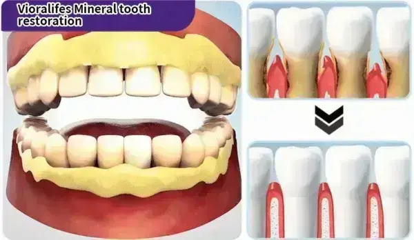 Teeth Restoration Mineral Powder - Image 17