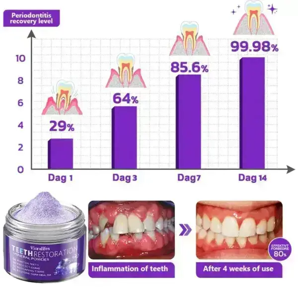 Teeth Restoration Mineral Powder - Image 18