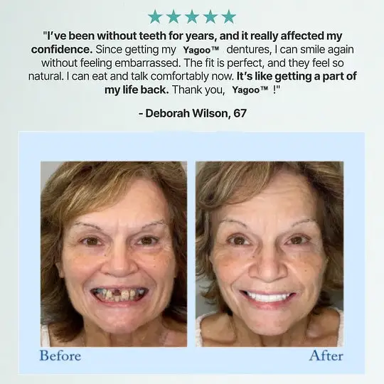 \Advanced Customized Full Denture Set - Image 12