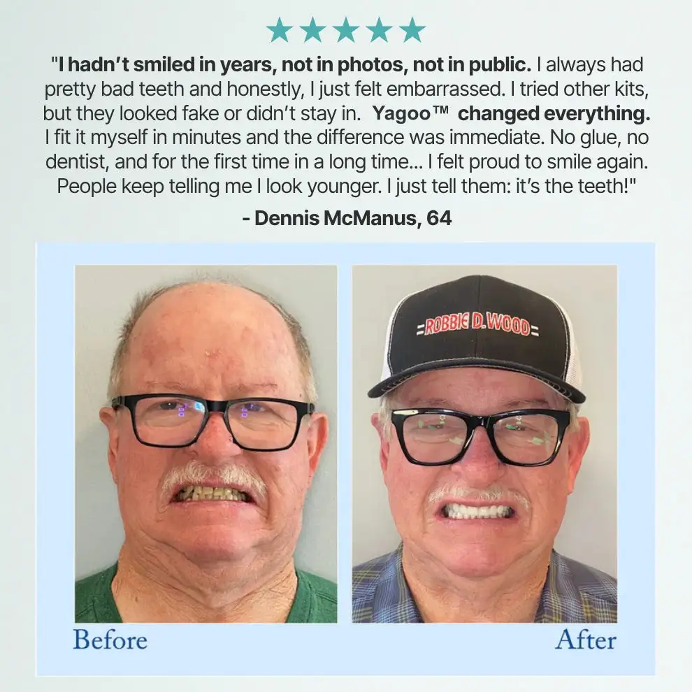 \Advanced Customized Full Denture Set - Image 13