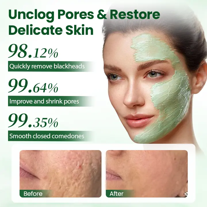 Avocado Acid Mask - Image 7