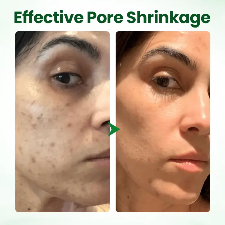 Avocado Acid Mask - Image 9