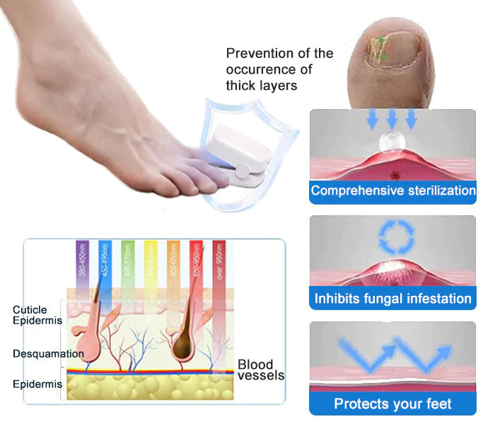 Powerful Light Therapy Device for Treating Nail Disorders - Image 8