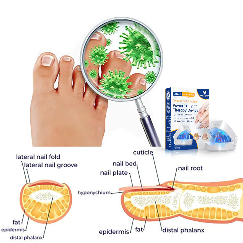 Powerful Light Therapy Device for Treating Nail Disorders - Image 6