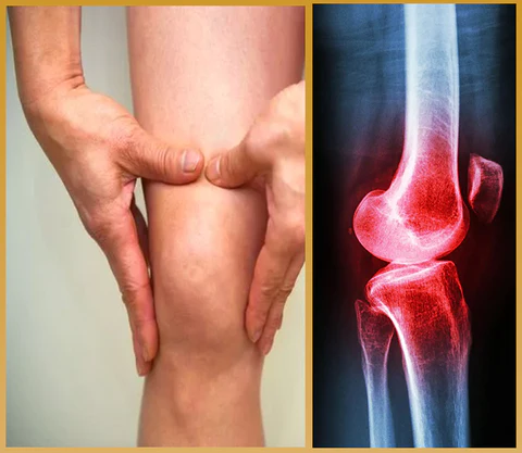 Joint & Bone Care Cream - Image 6