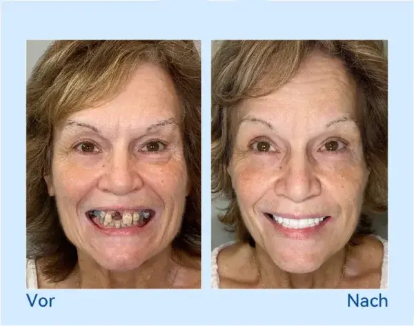 ๐ฆท๐
๐จ๐ซ๐ญ๐ฌ๐๐ก๐ซ๐ข๐ญ๐ญ๐ฅ๐ข๐๐ก ๐๐ร๐ ๐๐๐๐ซ๐ญ๐ข๐ ๐ญ ๐๐จ๐ฅ๐ฅ๐ฉ๐ซ๐จ๐ญ๐ก๐๐ฌ๐๐ง-๐๐๐ญ - Image 10